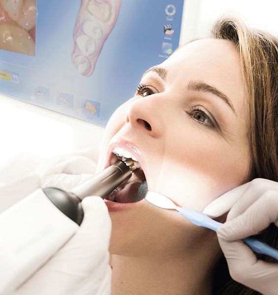 cerec-3